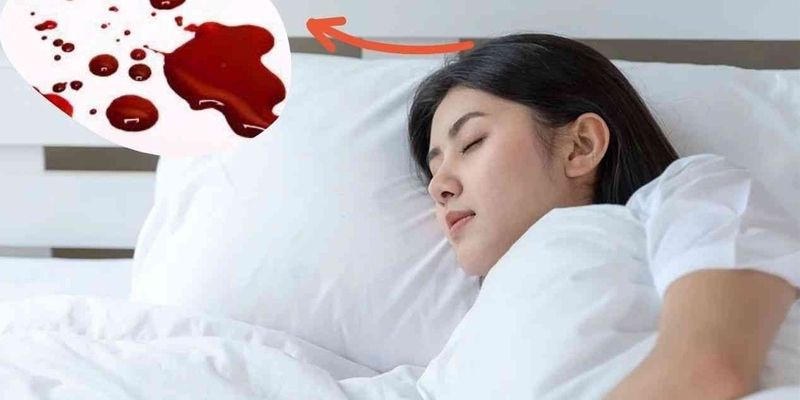 Mơ Thấy Máu Đánh Con Gì - Số Đẹp, Dễ Trúng Tại BONGVIP